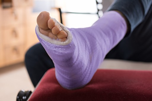 Foot and Ankle Stress Fractures