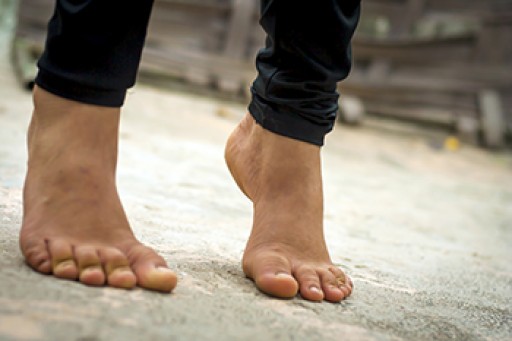 Hyperhidrosis of the Feet