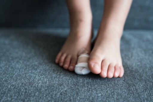 What to Know About a Broken Toe