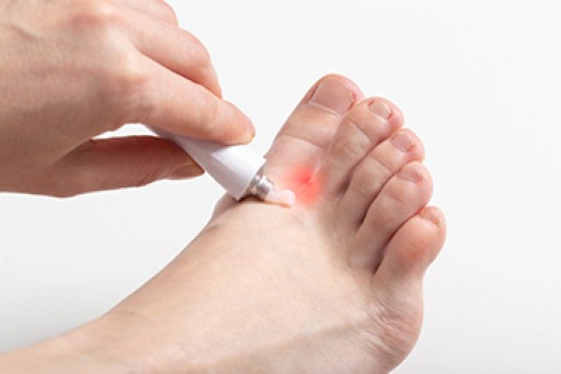 Effective Prevention Techniques for Athlete’s Foot